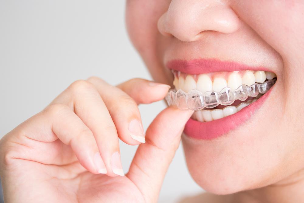 Crest UK – Brighten Your Smile with The White Smiles